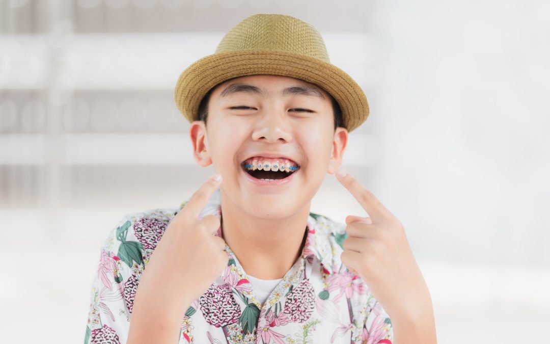 How do Braces Affect Gum Health?